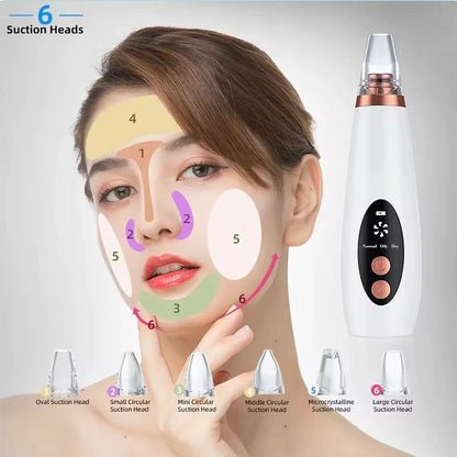Black heads removal