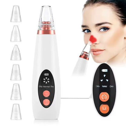 Black heads removal
